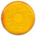 Staphylococcus aureus