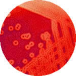 Streptococcus pyogenes